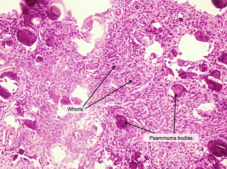 Can you solve this case? | Pathology Student