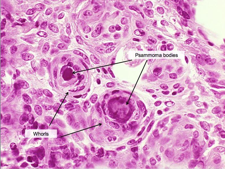 Can you solve this case? | Pathology Student